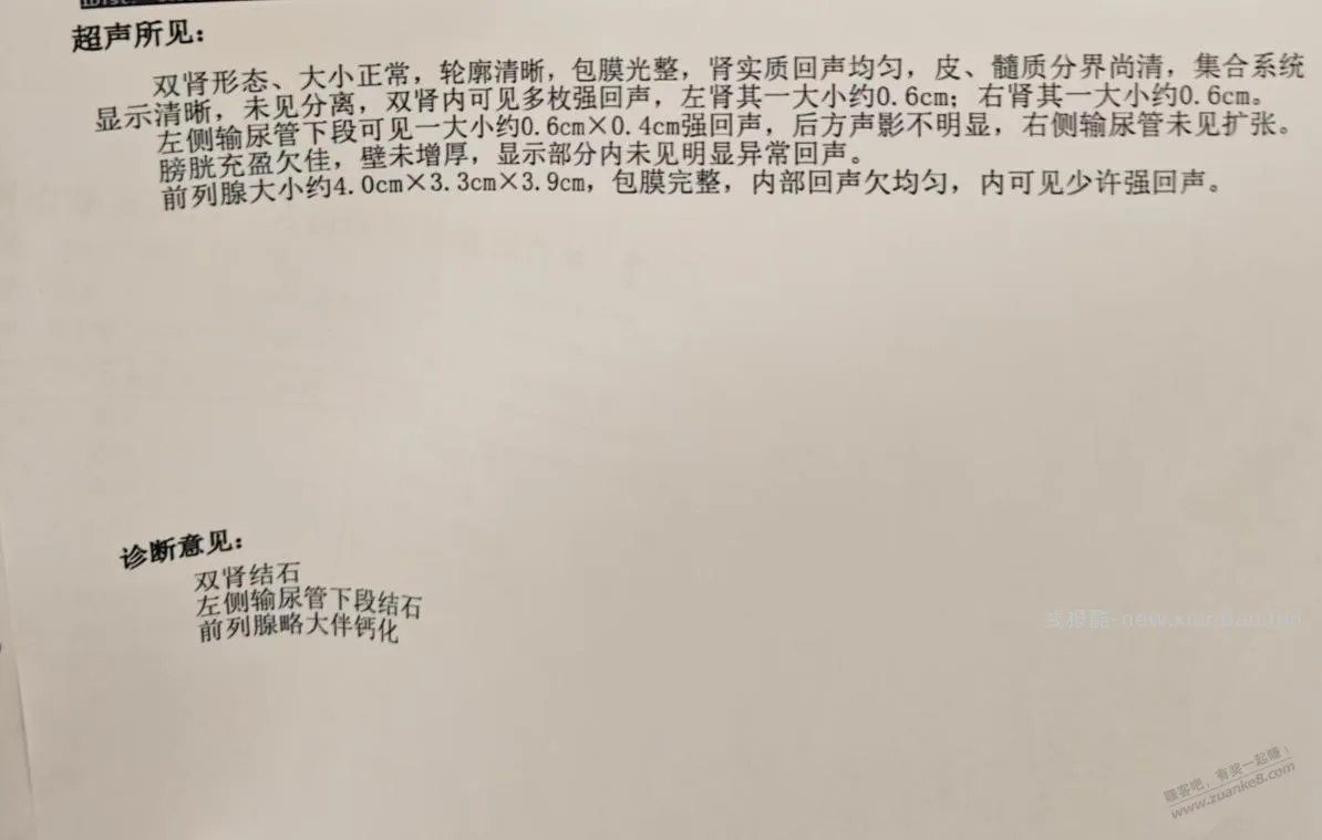 今天去了三家医院决定体外碎石了 - 线报酷 今天去了三家医院决定体外碎石了 - 线报酷